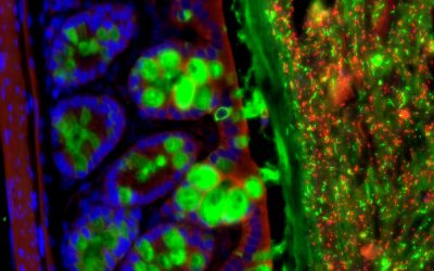 Gut Bacteria Have Outsized Influence
