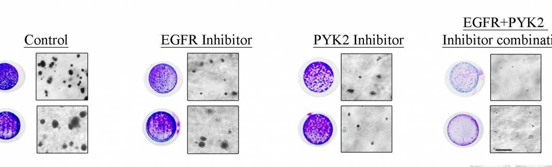 Double Whammy for Triple Negative Breast Cancer