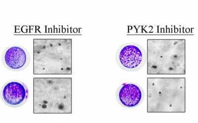 Double Whammy for Triple Negative Breast Cancer