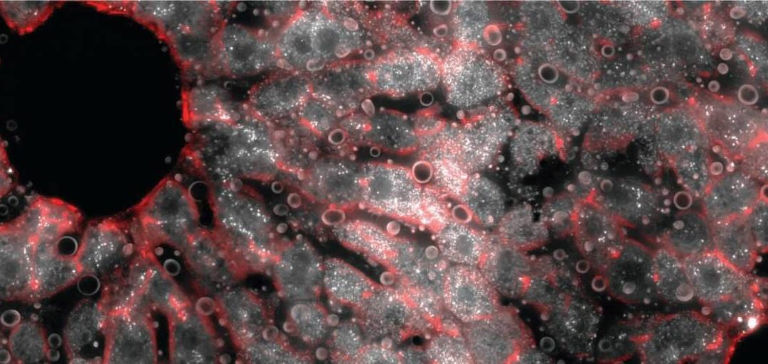Gene Analysis Adds Layers to Understanding How Our Livers Function