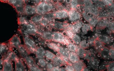 Gene Analysis Adds Layers to Understanding How Our Livers Function
