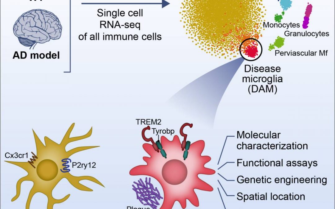 A newly discovered immune cell type may lead to a future treatment for Alzheimer’s disease