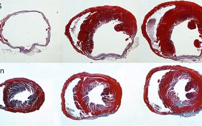 Restoring Cardiac Function with a Matrix Molecule