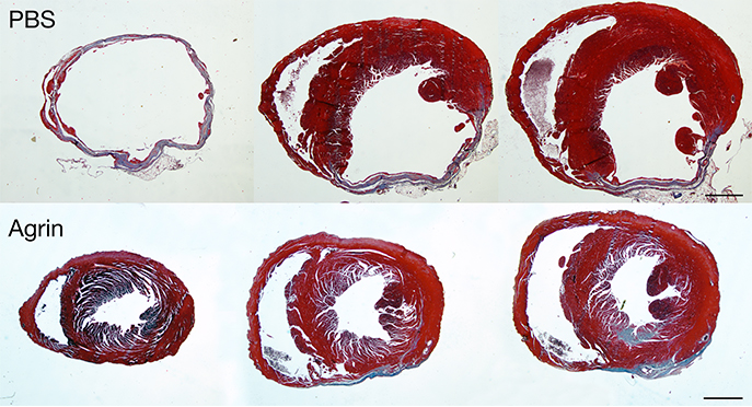 Restoring Cardiac Function with a Matrix Molecule