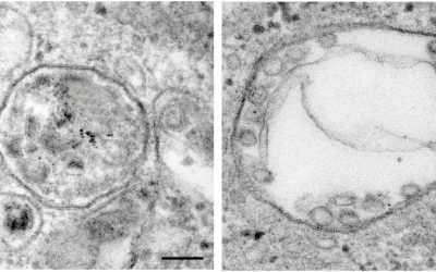 Verdict in the Cell: A Last-Minute Molecular Mechanism Prevents Cellular Death