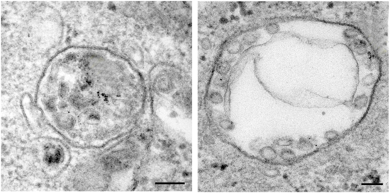 Verdict in the Cell: A Last-Minute Molecular Mechanism Prevents Cellular Death