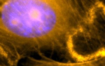 Reshaping the Surface: Wave Fronts Ruffle the Cell Membrane