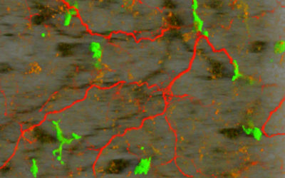 “Big Eater” Cells’ New Role – in Preventing Obesity