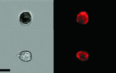 The Zombie Cell Census