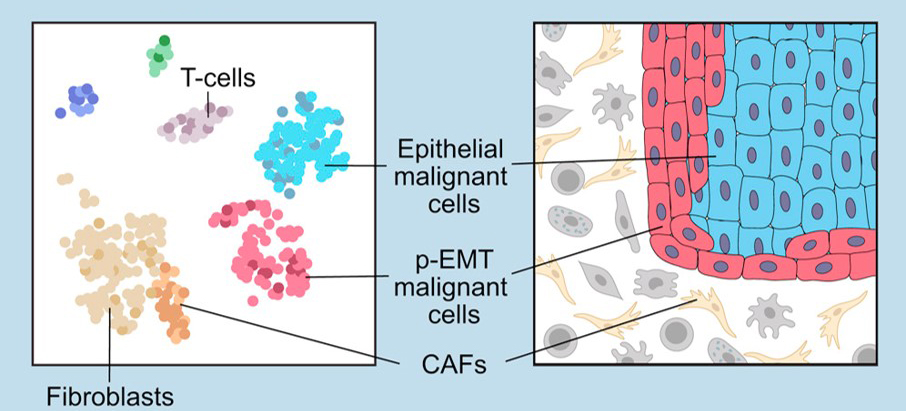 Comprehending Cancer Ecosystems – One Cell at a Time