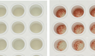 Immune Tolerance May Open New Horizons for Bone Marrow and Organ Transplants