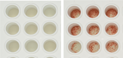 Immune Tolerance May Open New Horizons for Bone Marrow and Organ Transplants