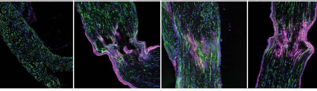 “Lord of the Rings” Protein Jump-Starts Nerve Repair