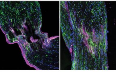 “Lord of the Rings” Protein Jump-Starts Nerve Repair