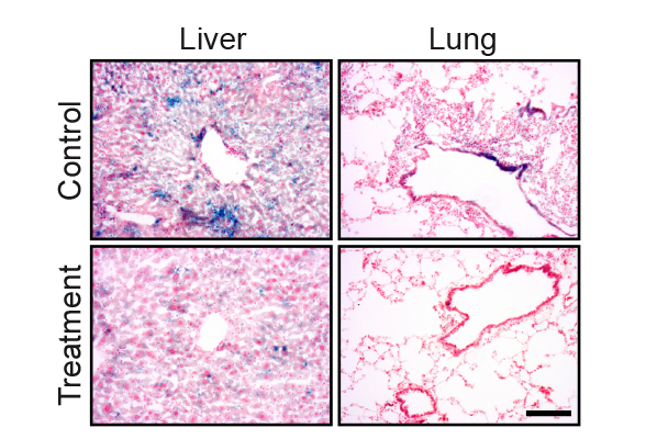 The Immune System’s Fountain of Youth