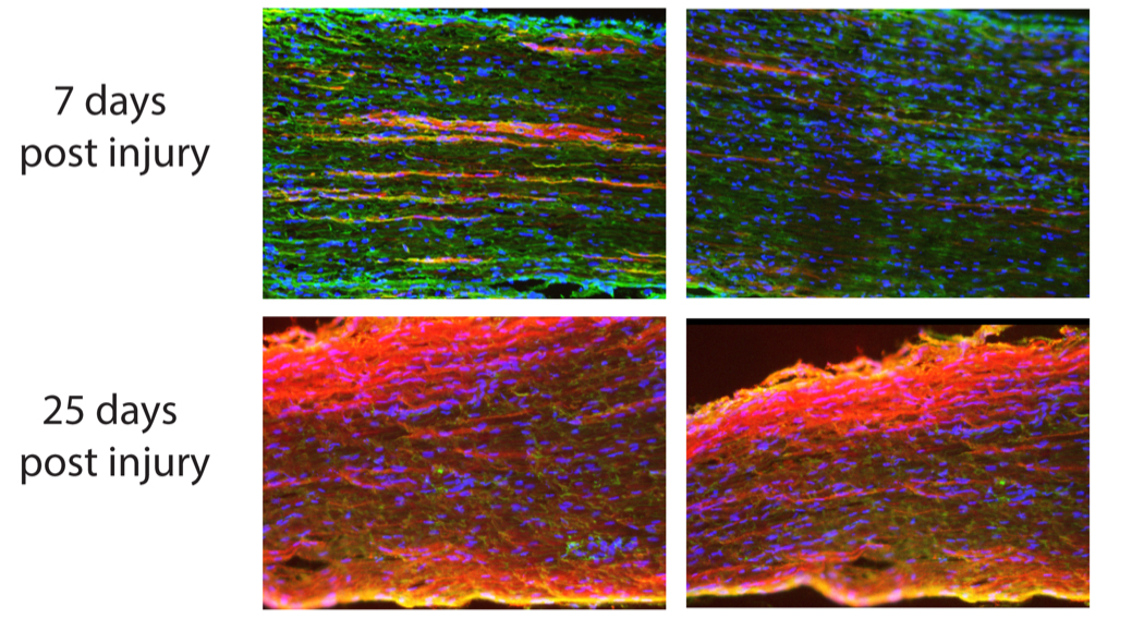 RNA “Specialists” Activate Nerve Regeneration