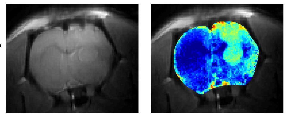 CEST la vie: High-Powered Magnets Improve Early Detection of Cancer in Rats