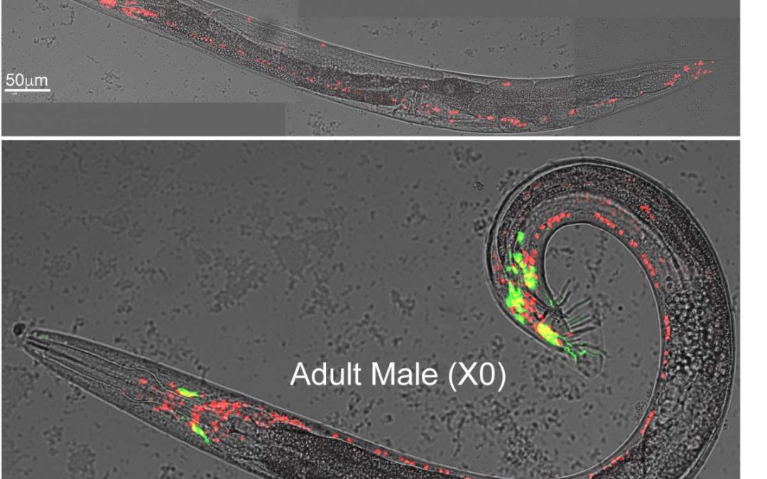 When Male and Female Brain Connections Break Down Differently