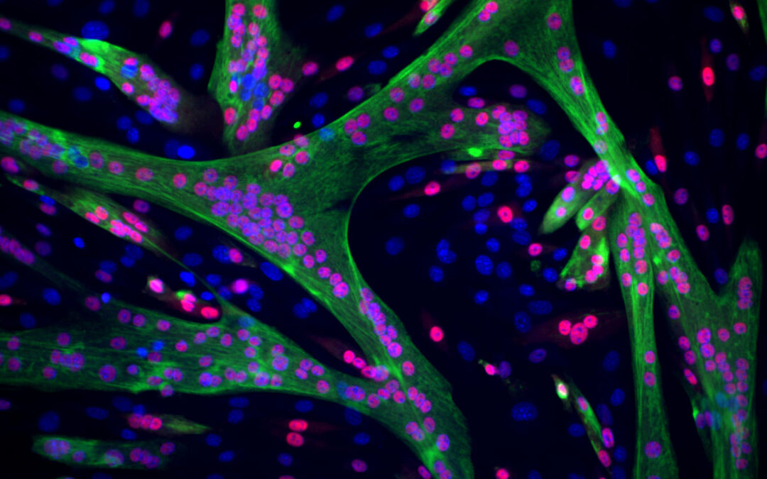 A machine learning model sheds new light on muscle development