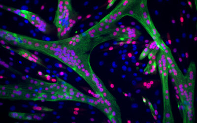 A machine learning model sheds new light on muscle development