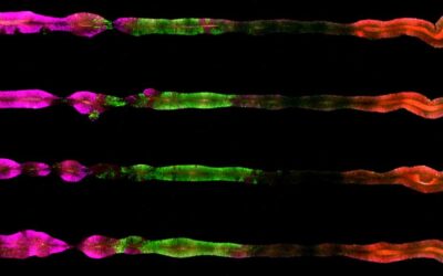 Researchers from the University of Michigan and the Weizmann Institute develop the first-ever complete central nervous system on a chip: It faithfully emulates that of a human embryo, from the forebrain to the bottom of the spinal cord